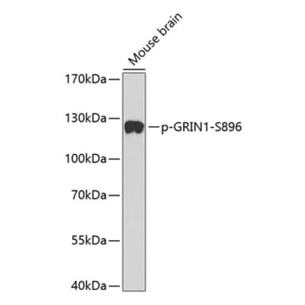 Western Blot - Anti-NMDAR1 (phospho Ser896) Antibody (A16484) - Antibodies.com