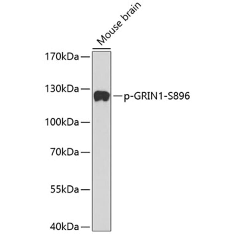 Western Blot - Anti-NMDAR1 (phospho Ser896) Antibody (A16484) - Antibodies.com