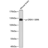 Western Blot - Anti-NMDAR1 (phospho Ser896) Antibody (A16484) - Antibodies.com