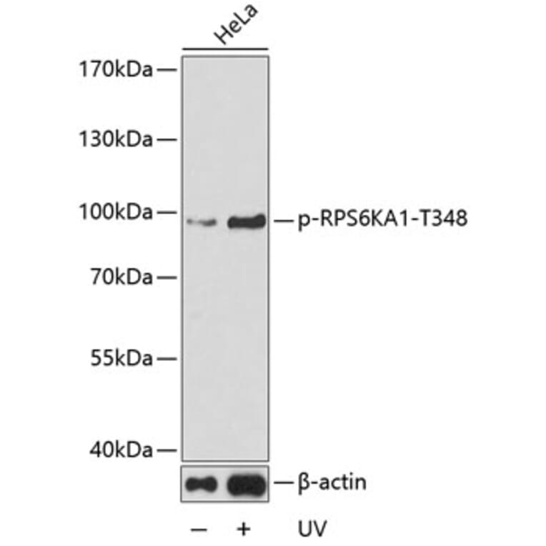 Western Blot - Anti-P90RSK (phospho T348) Antibody (AP0166) - Antibodies.com