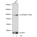 Western Blot - Anti-P90RSK (phospho T348) Antibody (AP0166) - Antibodies.com
