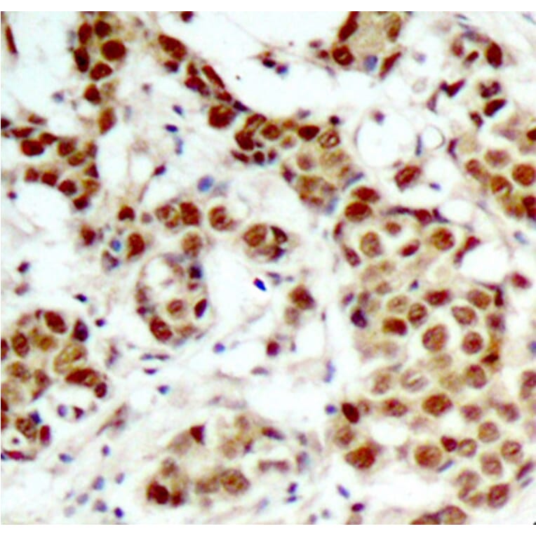 Immunohistochemistry - Anti-P90RSK (phospho T348) Antibody (AP0166) - Antibodies.com