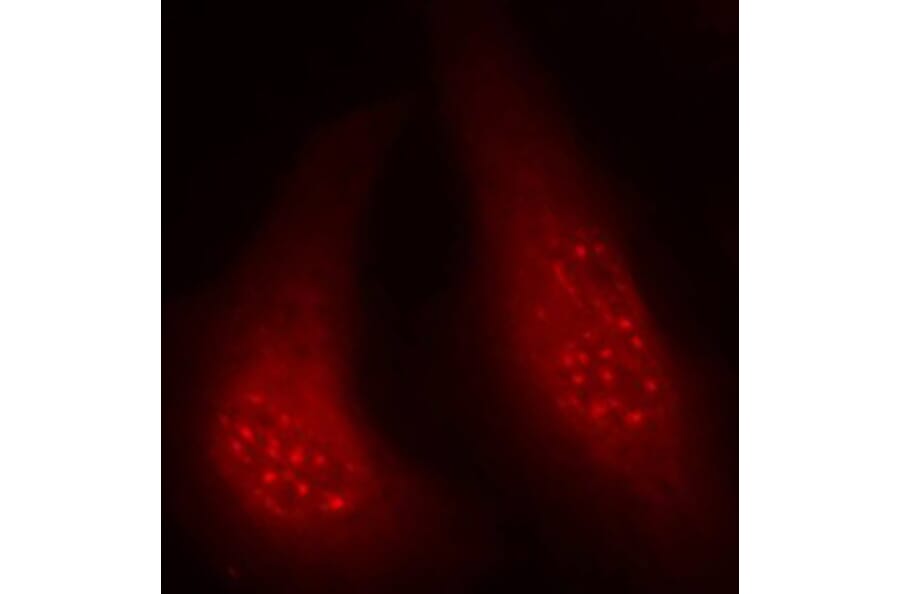Immunofluorescence - Anti-P90RSK (phospho T348) Antibody (AP0166) - Antibodies.com