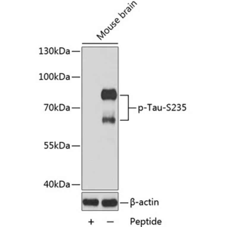 Western Blot - Anti-Tau (phospho S235) Antibody (AP0167) - Antibodies.com