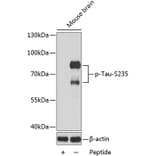 Western Blot - Anti-Tau (phospho S235) Antibody (AP0167) - Antibodies.com