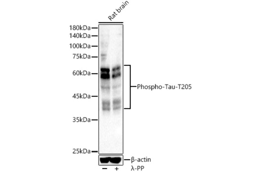 Western Blot - Anti-Tau (phospho Thr205) Antibody (A16487) - Antibodies.com
