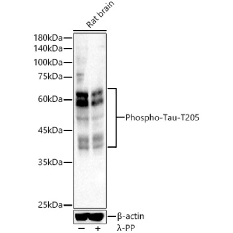 Western Blot - Anti-Tau (phospho Thr205) Antibody (A16487) - Antibodies.com