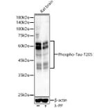 Western Blot - Anti-Tau (phospho Thr205) Antibody (A16487) - Antibodies.com