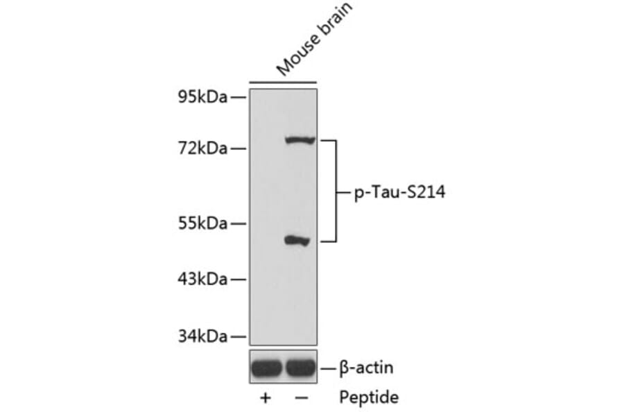 Western Blot - Anti-Tau (phospho S214) Antibody (AP0169) - Antibodies.com