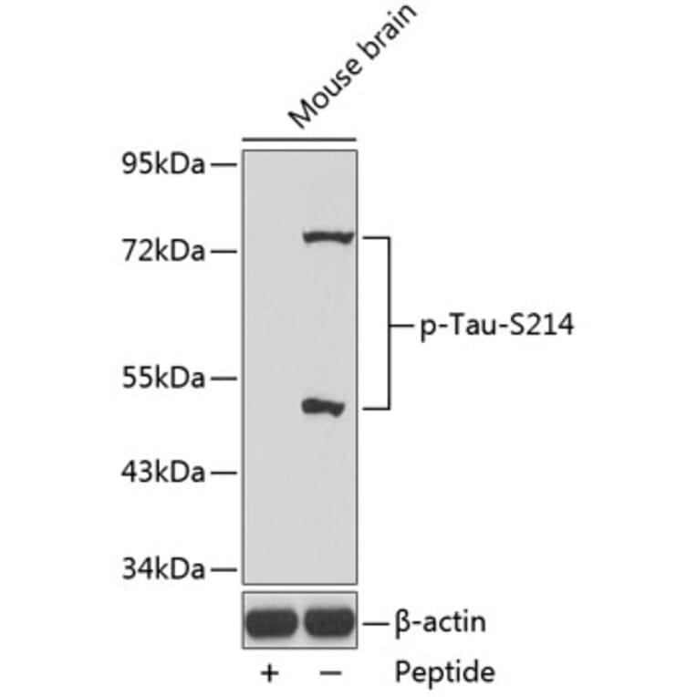 Western Blot - Anti-Tau (phospho S214) Antibody (AP0169) - Antibodies.com