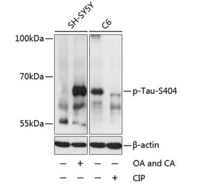 Western Blot - Anti-Tau (phospho Ser404) Antibody (A16489) - Antibodies.com