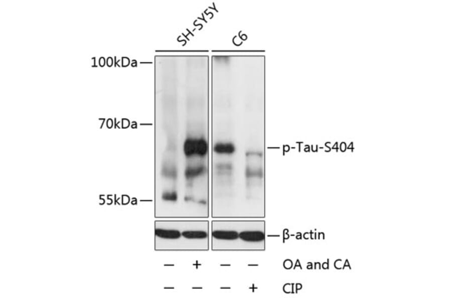 Western Blot - Anti-Tau (phospho Ser404) Antibody (A16489) - Antibodies.com