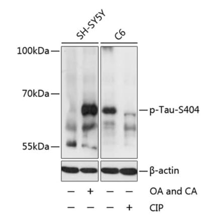 Western Blot - Anti-Tau (phospho Ser404) Antibody (A16489) - Antibodies.com