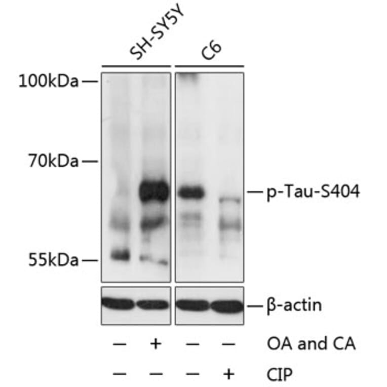 Western Blot - Anti-Tau (phospho Ser404) Antibody (A16489) - Antibodies.com