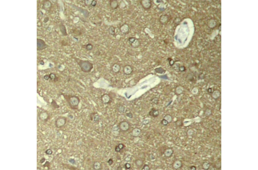 Immunohistochemistry - Anti-Tau (phospho Ser404) Antibody (A16489) - Antibodies.com