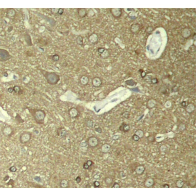 Immunohistochemistry - Anti-Tau (phospho Ser404) Antibody (A16489) - Antibodies.com