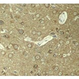 Immunohistochemistry - Anti-Tau (phospho Ser404) Antibody (A16489) - Antibodies.com