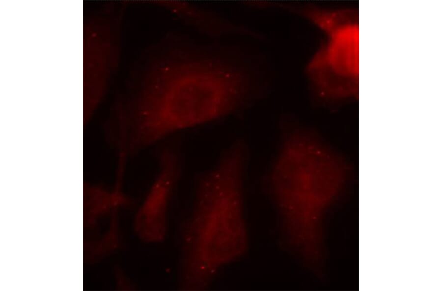 Immunofluorescence - Anti-Tau (phospho Ser404) Antibody (A16489) - Antibodies.com