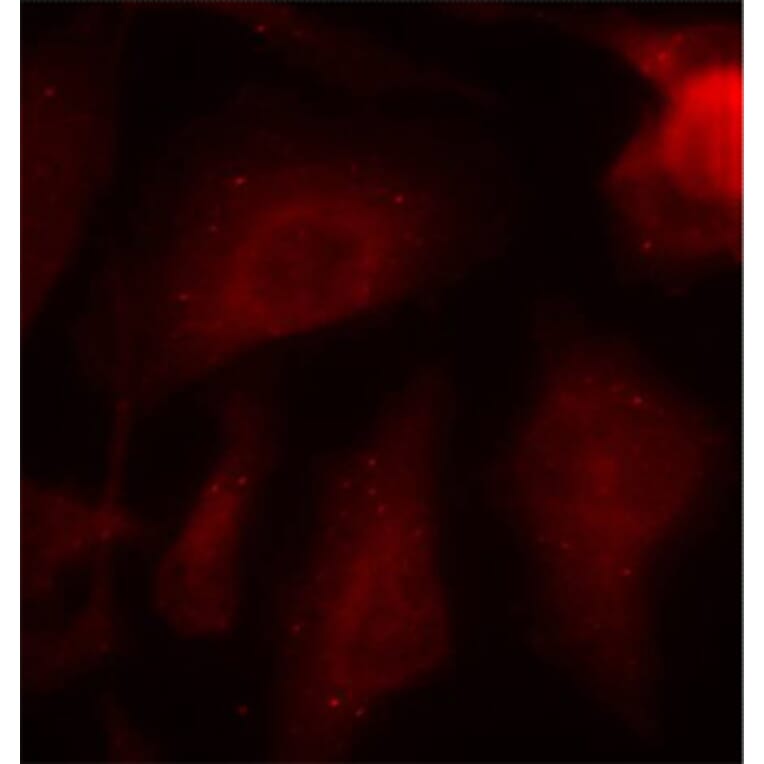 Immunofluorescence - Anti-Tau (phospho Ser404) Antibody (A16489) - Antibodies.com