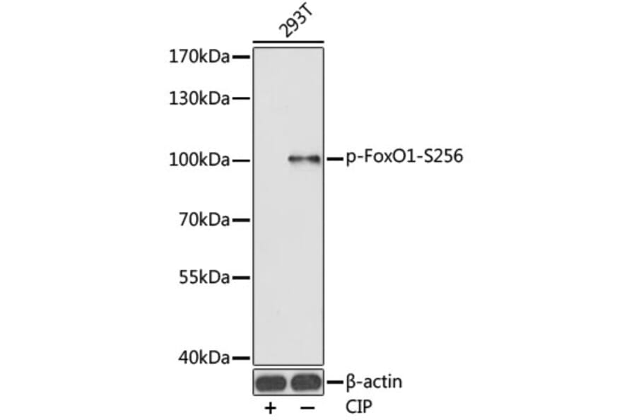 Western Blot - Anti-FOXO1A (phospho Ser256) Antibody (A16490) - Antibodies.com