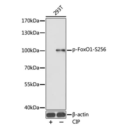 Western Blot - Anti-FOXO1A (phospho Ser256) Antibody (A16490) - Antibodies.com