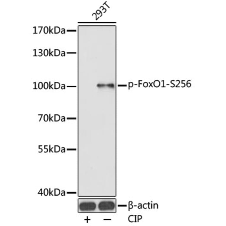 Western Blot - Anti-FOXO1A (phospho Ser256) Antibody (A16490) - Antibodies.com