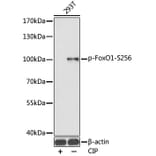 Western Blot - Anti-FOXO1A (phospho Ser256) Antibody (A16490) - Antibodies.com
