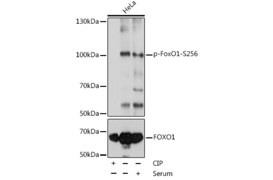 Western Blot - Anti-FOXO1A (phospho Ser256) Antibody (A16490) - Antibodies.com