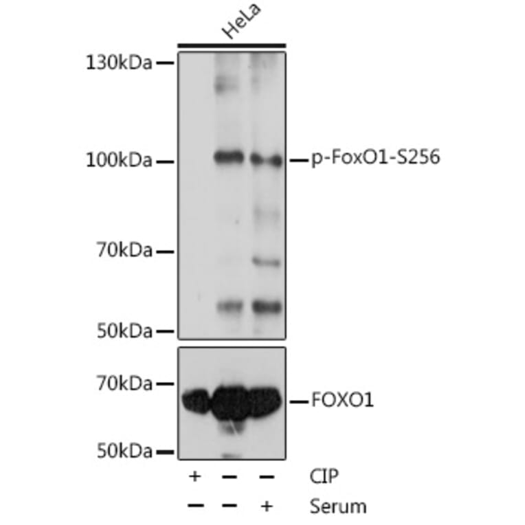 Western Blot - Anti-FOXO1A (phospho Ser256) Antibody (A16490) - Antibodies.com