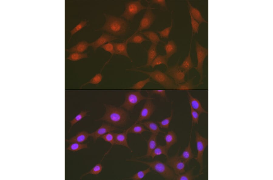 Immunofluorescence - Anti-FOXO1A (phospho Ser256) Antibody (A16490) - Antibodies.com