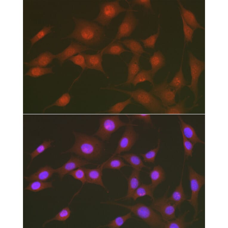 Immunofluorescence - Anti-FOXO1A (phospho Ser256) Antibody (A16490) - Antibodies.com