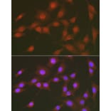 Immunofluorescence - Anti-FOXO1A (phospho Ser256) Antibody (A16490) - Antibodies.com