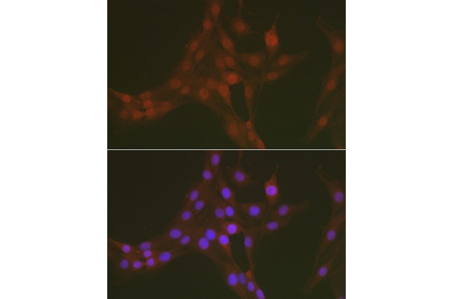 Immunofluorescence - Anti-FOXO1A (phospho Ser256) Antibody (A16490) - Antibodies.com