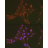 Immunofluorescence - Anti-FOXO1A (phospho Ser256) Antibody (A16490) - Antibodies.com