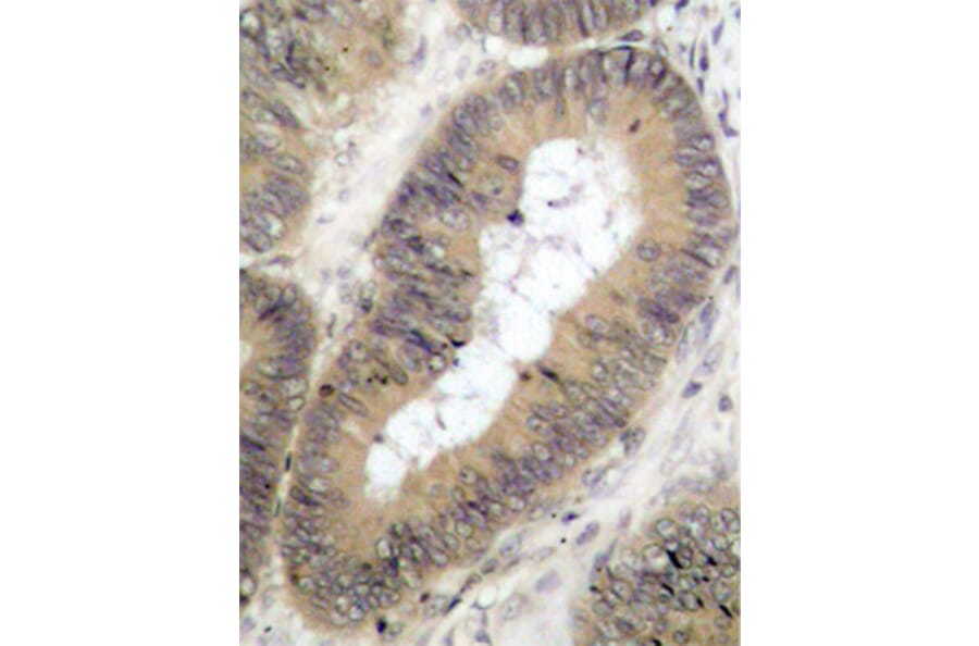 Immunohistochemistry - Anti-CHUK (phospho T23) Antibody (AP0173) - Antibodies.com