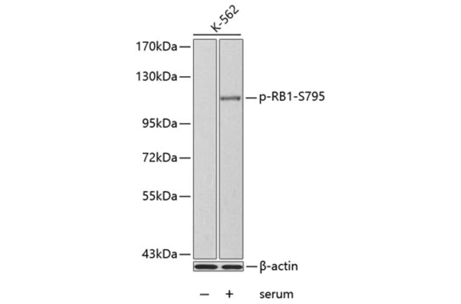 Western Blot - Anti-RB1 (phospho S795) Antibody (AP0174) - Antibodies.com