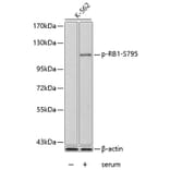 Western Blot - Anti-RB1 (phospho S795) Antibody (AP0174) - Antibodies.com