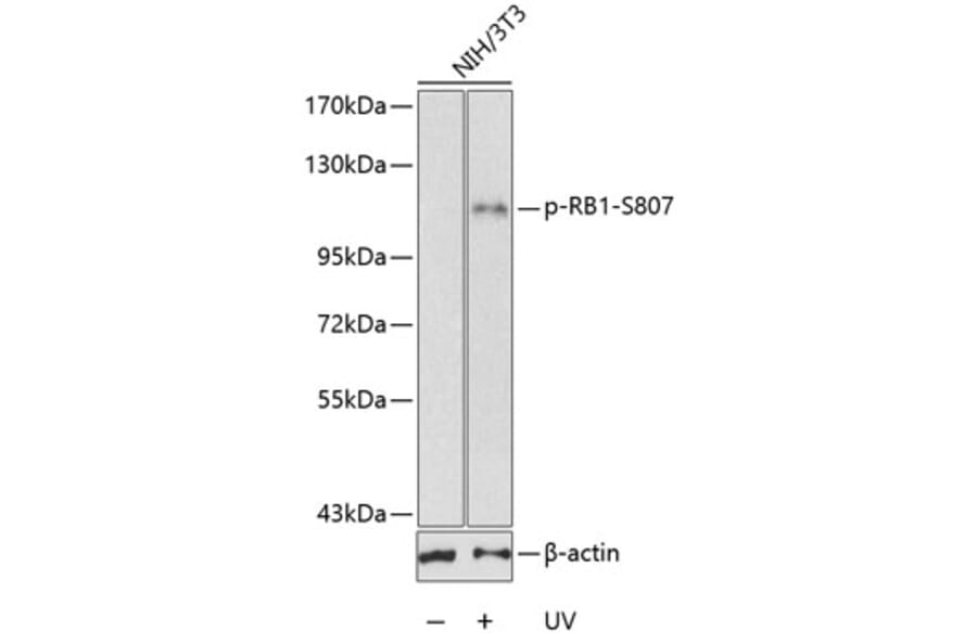Western Blot - Anti-RB1 (phospho S807) Antibody (AP0175) - Antibodies.com