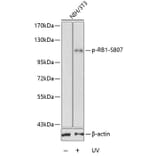 Western Blot - Anti-RB1 (phospho S807) Antibody (AP0175) - Antibodies.com