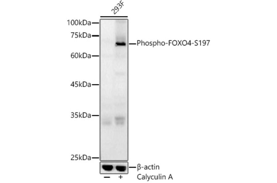 Western Blot - Anti-FOXO4/AFX (phospho Ser197) Antibody (A16494) - Antibodies.com