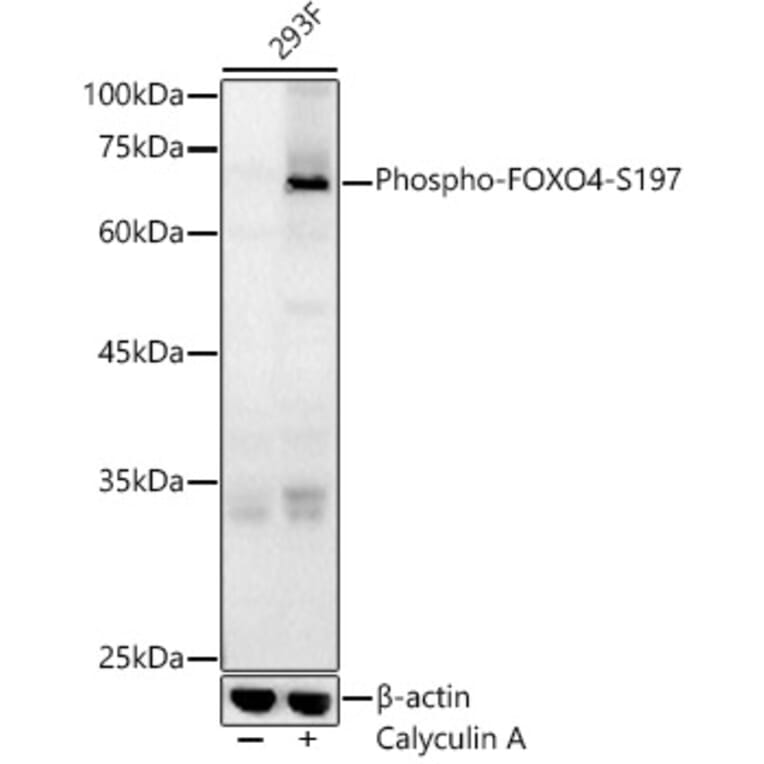 Western Blot - Anti-FOXO4/AFX (phospho Ser197) Antibody (A16494) - Antibodies.com