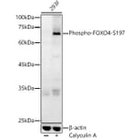 Western Blot - Anti-FOXO4/AFX (phospho Ser197) Antibody (A16494) - Antibodies.com