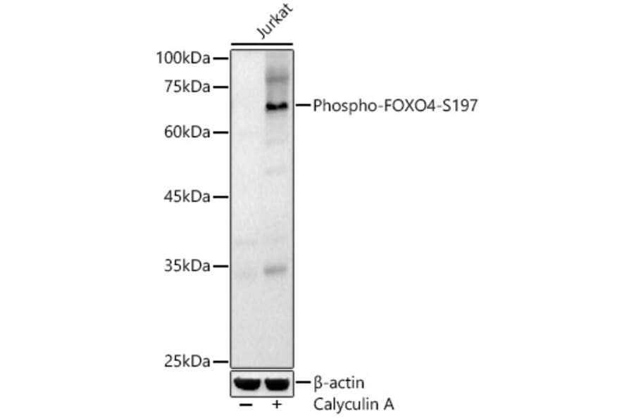 Western Blot - Anti-FOXO4/AFX (phospho Ser197) Antibody (A16494) - Antibodies.com