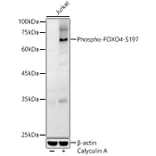 Western Blot - Anti-FOXO4/AFX (phospho Ser197) Antibody (A16494) - Antibodies.com