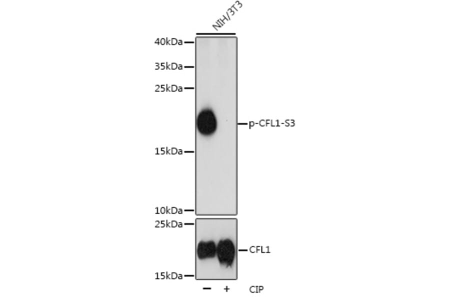 Western Blot - Anti-Cofilin (phospho Ser3) Antibody (A16495) - Antibodies.com
