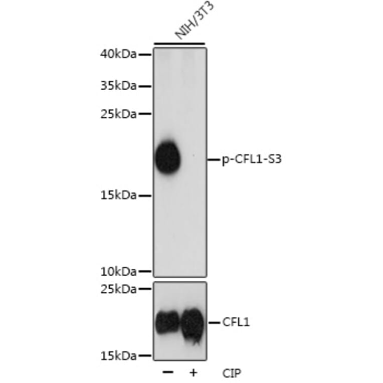 Western Blot - Anti-Cofilin (phospho Ser3) Antibody (A16495) - Antibodies.com