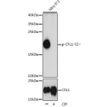 Western Blot - Anti-Cofilin (phospho Ser3) Antibody (A16495) - Antibodies.com