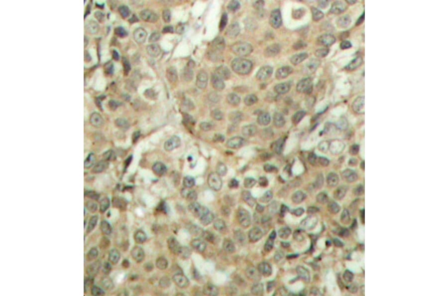 Immunohistochemistry - Anti-Cofilin (phospho Ser3) Antibody (A16495) - Antibodies.com