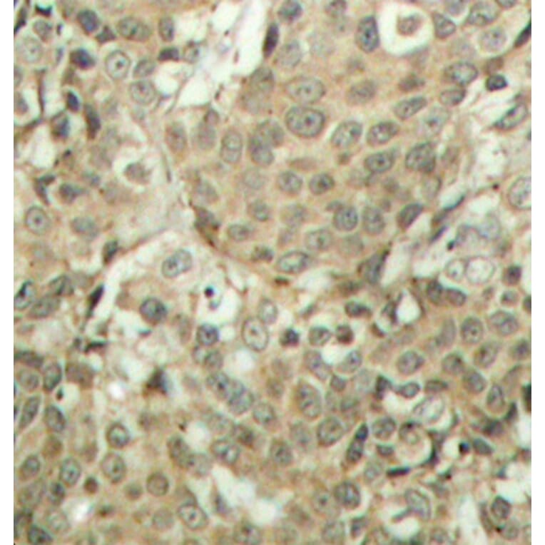 Immunohistochemistry - Anti-Cofilin (phospho Ser3) Antibody (A16495) - Antibodies.com