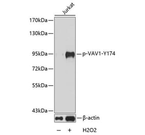 Western Blot - Anti-VAV1 (phospho Tyr174) Antibody (A16496) - Antibodies.com